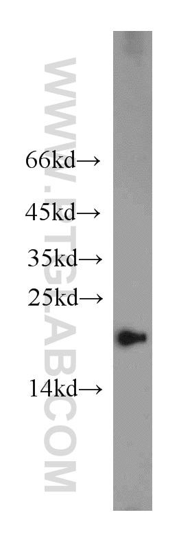 WB analysis of Jurkat using 20440-1-AP