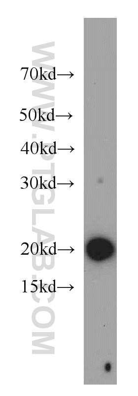 Western Blot (WB) analysis of K-562 cells using COPZ1 Polyclonal antibody (20440-1-AP)