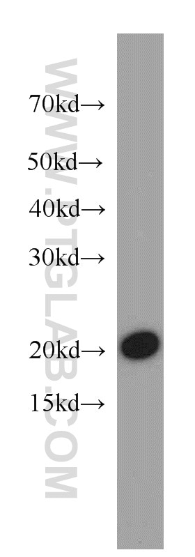 Western Blot (WB) analysis of COS-7 cells using COPZ1 Polyclonal antibody (20440-1-AP)