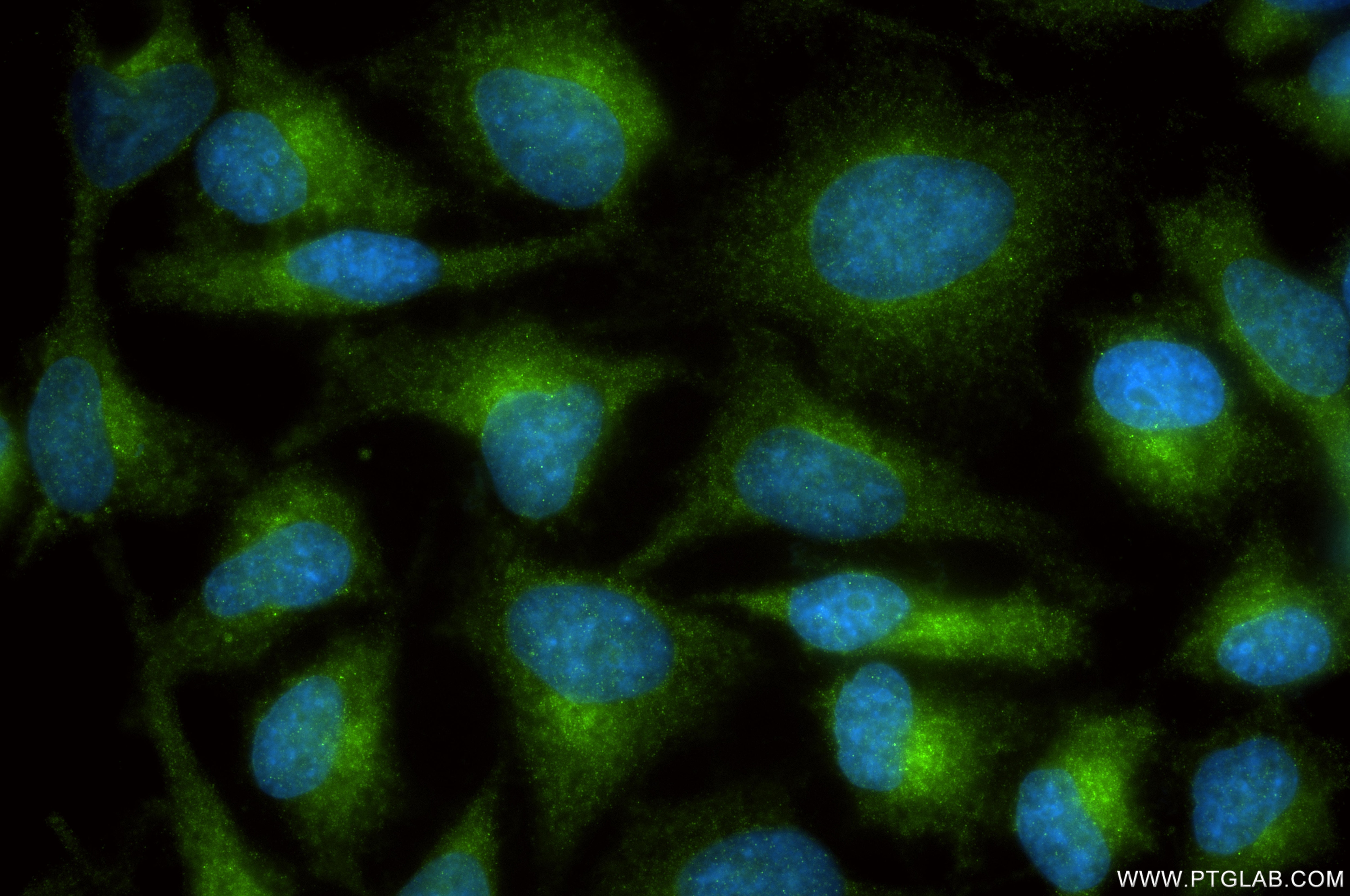 Immunofluorescence (IF) / fluorescent staining of HeLa cells using COPZ1 Recombinant monoclonal antibody (86014-1-RR)
