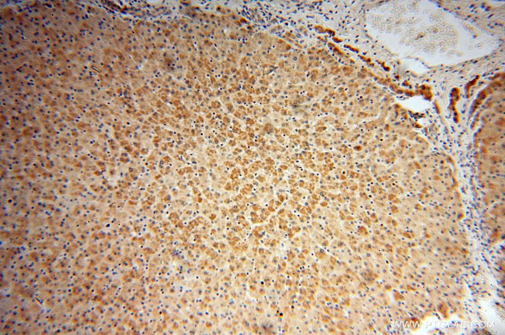 IHC staining of human liver using 17812-1-AP