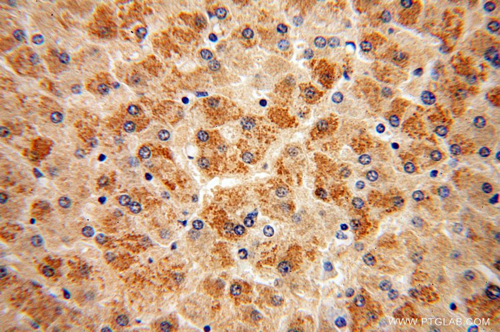 Immunohistochemistry (IHC) staining of human liver tissue using COQ10A Polyclonal antibody (17812-1-AP)