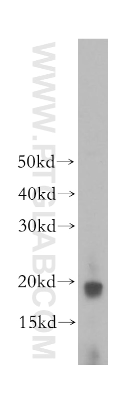 Western Blot (WB) analysis of human heart tissue using COQ10A Polyclonal antibody (17812-1-AP)