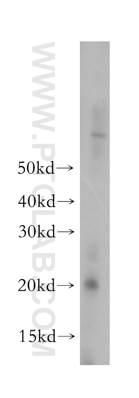Western Blot (WB) analysis of mouse skeletal muscle tissue using COQ10A Polyclonal antibody (17812-1-AP)