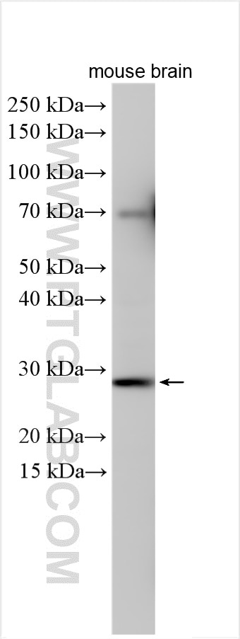 Western Blot (WB) analysis of various lysates using COQ10B Polyclonal antibody (17269-1-AP)