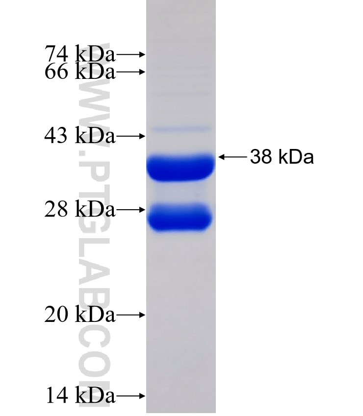 COQ2 fusion protein Ag29155 SDS-PAGE