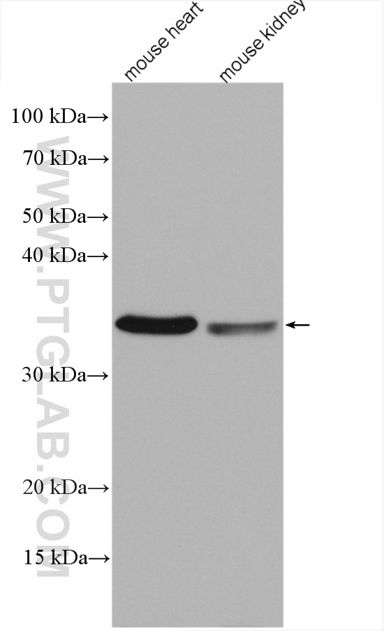 Western Blot (WB) analysis of various lysates using COQ3 Polyclonal antibody (28051-1-AP)