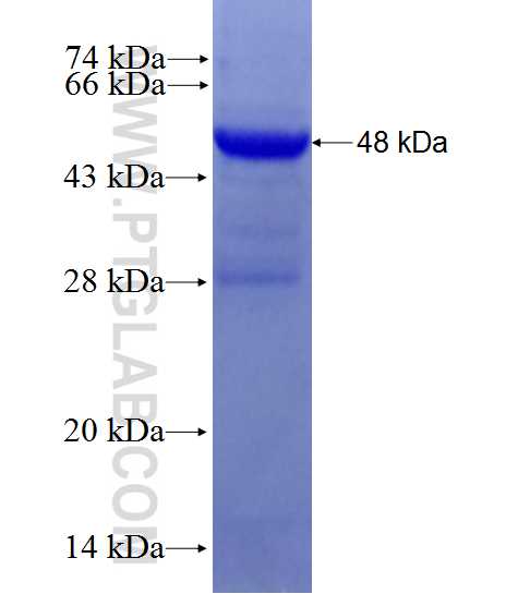 COQ3 fusion protein Ag27740 SDS-PAGE