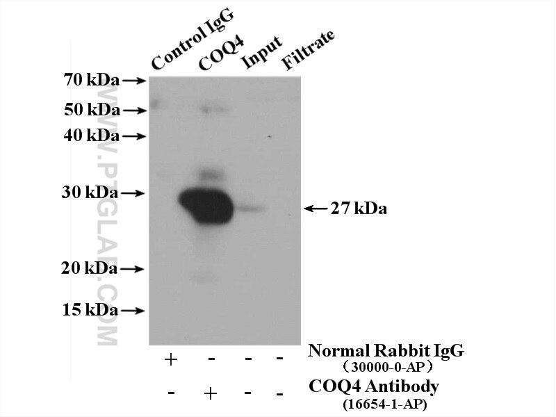 Immunoprecipitation (IP) experiment of mouse liver tissue using COQ4 Polyclonal antibody (16654-1-AP)