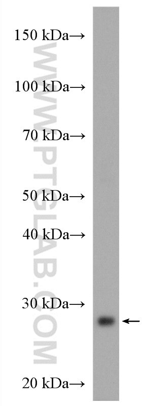 Western Blot (WB) analysis of mouse liver tissue using COQ4 Polyclonal antibody (16654-1-AP)