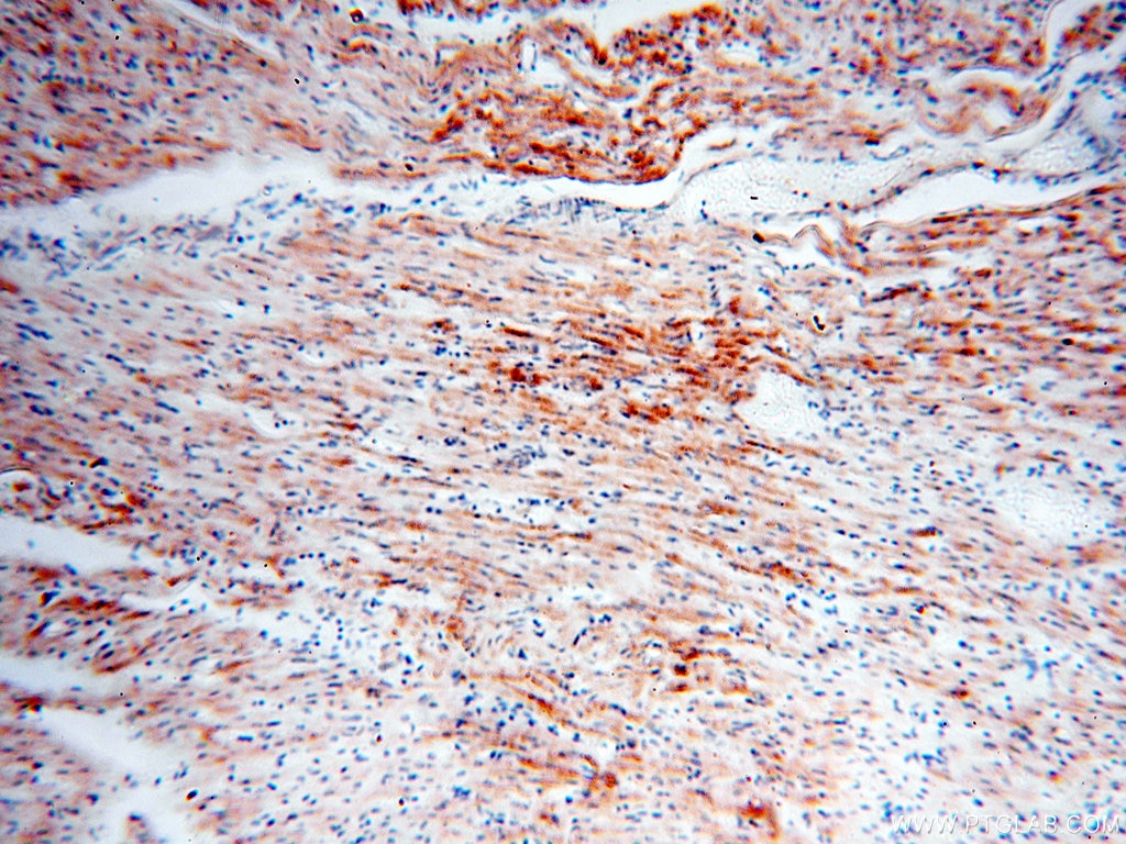 IHC staining of human heart using 17453-1-AP