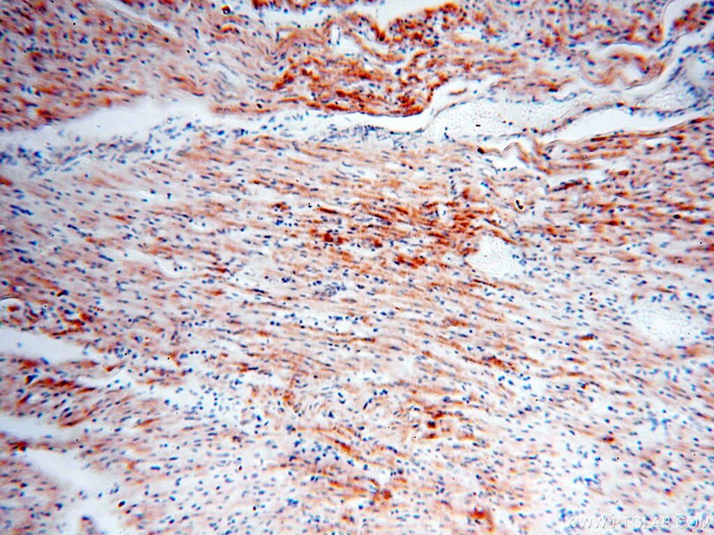 Immunohistochemistry (IHC) staining of human heart tissue using COQ5 Polyclonal antibody (17453-1-AP)