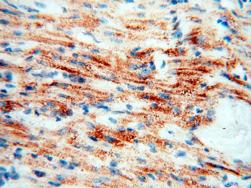 Immunohistochemistry (IHC) staining of human heart tissue using COQ5 Polyclonal antibody (17453-1-AP)