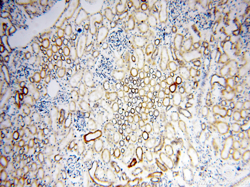 Immunohistochemistry (IHC) staining of human kidney tissue using COQ5 Polyclonal antibody (17453-1-AP)
