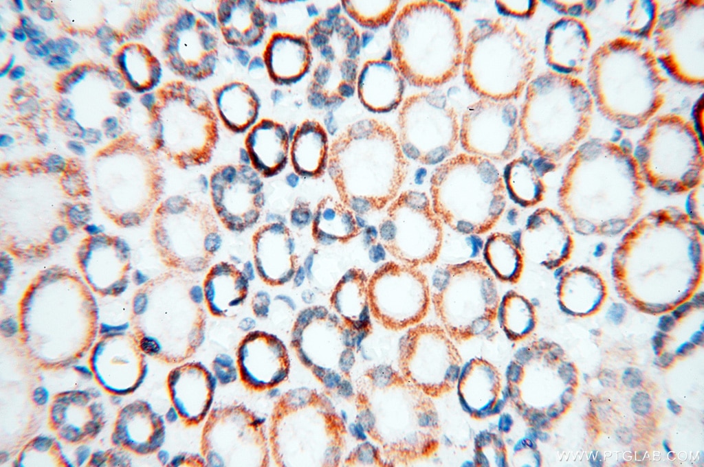 Immunohistochemistry (IHC) staining of human kidney tissue using COQ5 Polyclonal antibody (17453-1-AP)