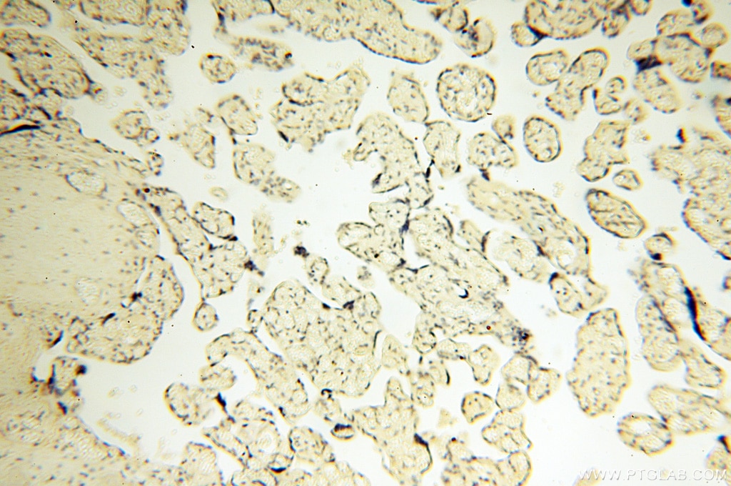 Immunohistochemistry (IHC) staining of human placenta tissue using COQ5 Polyclonal antibody (17453-1-AP)