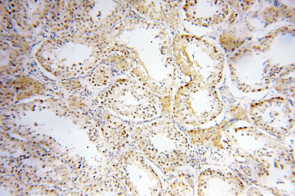 Immunohistochemistry (IHC) staining of human testis tissue using COQ5 Polyclonal antibody (17453-1-AP)
