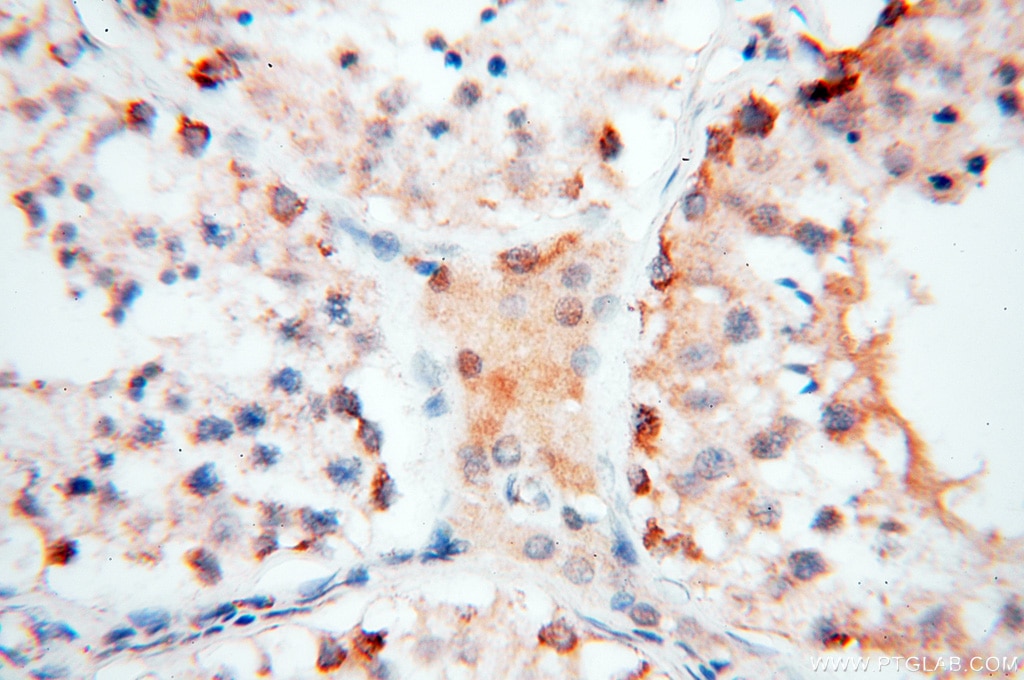 Immunohistochemistry (IHC) staining of human testis tissue using COQ5 Polyclonal antibody (17453-1-AP)