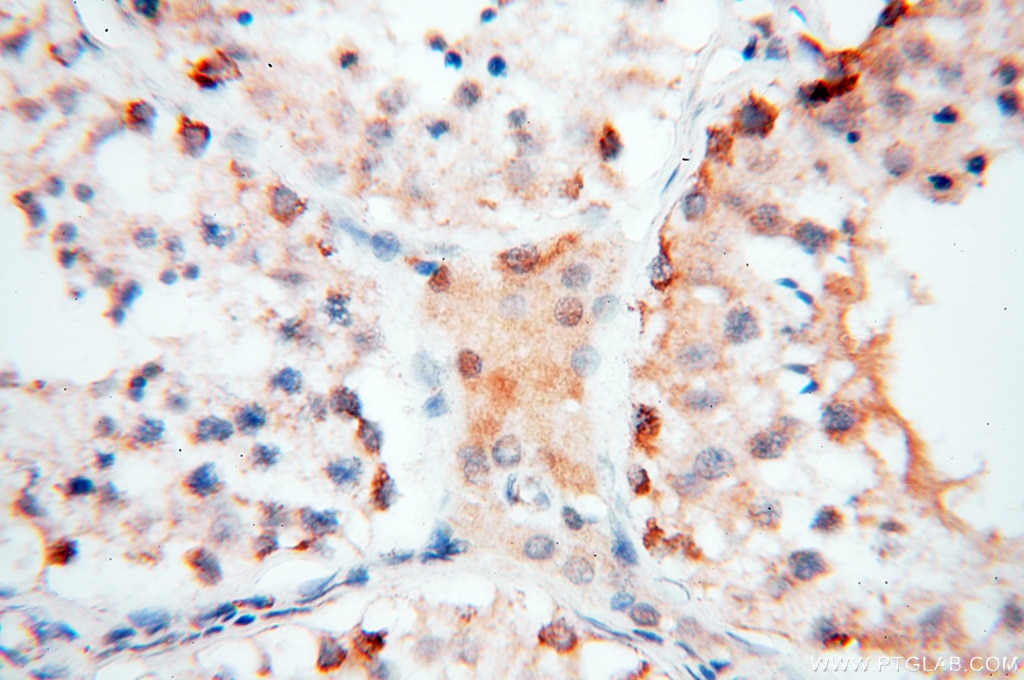 IHC staining of human testis using 17453-1-AP