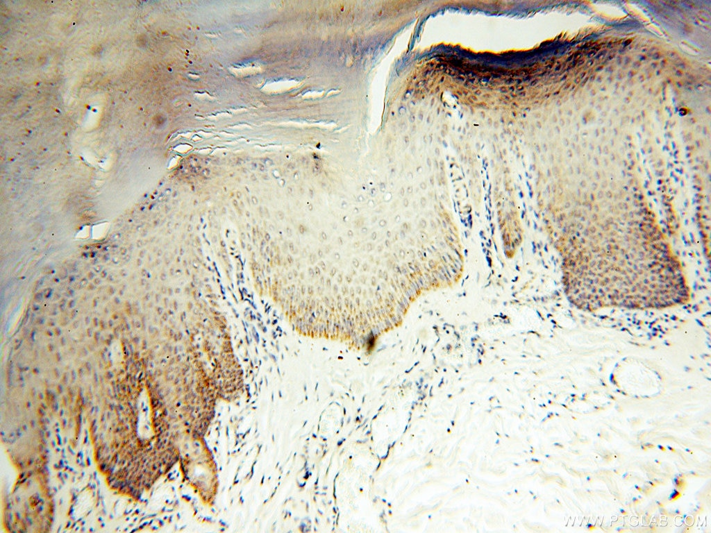 Immunohistochemistry (IHC) staining of human skin tissue using COQ5 Polyclonal antibody (17453-1-AP)