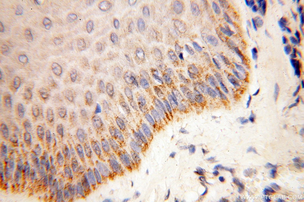 Immunohistochemistry (IHC) staining of human skin tissue using COQ5 Polyclonal antibody (17453-1-AP)