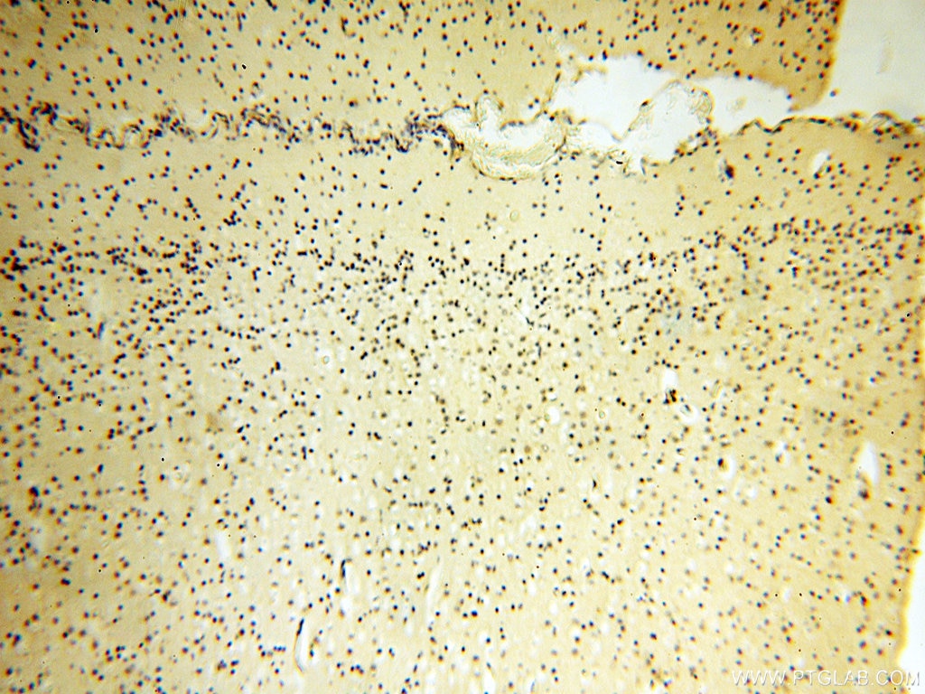 Immunohistochemistry (IHC) staining of human brain tissue using COQ5 Polyclonal antibody (17453-1-AP)