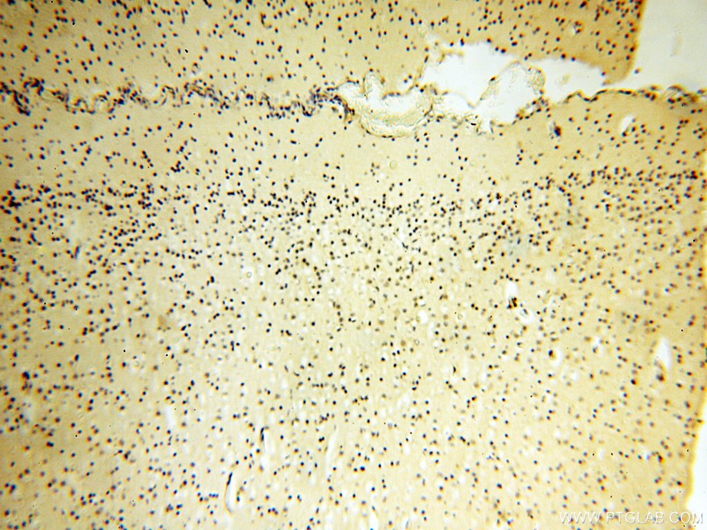 IHC staining of human brain using 17453-1-AP