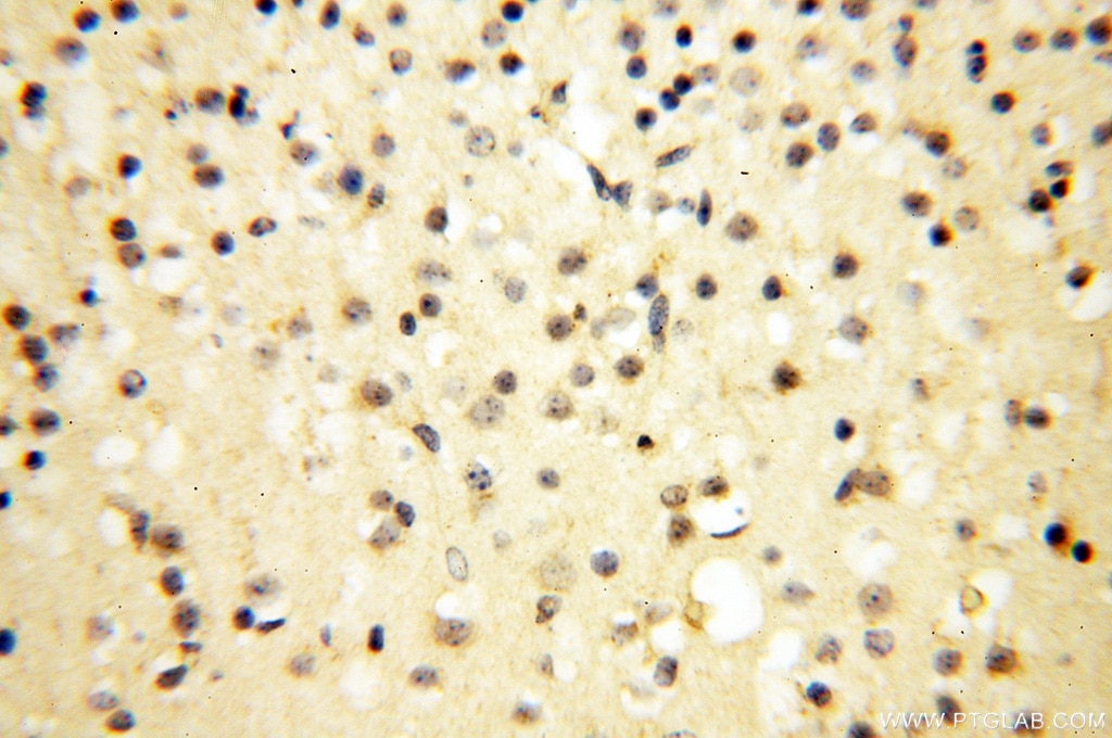 Immunohistochemistry (IHC) staining of human brain tissue using COQ5 Polyclonal antibody (17453-1-AP)