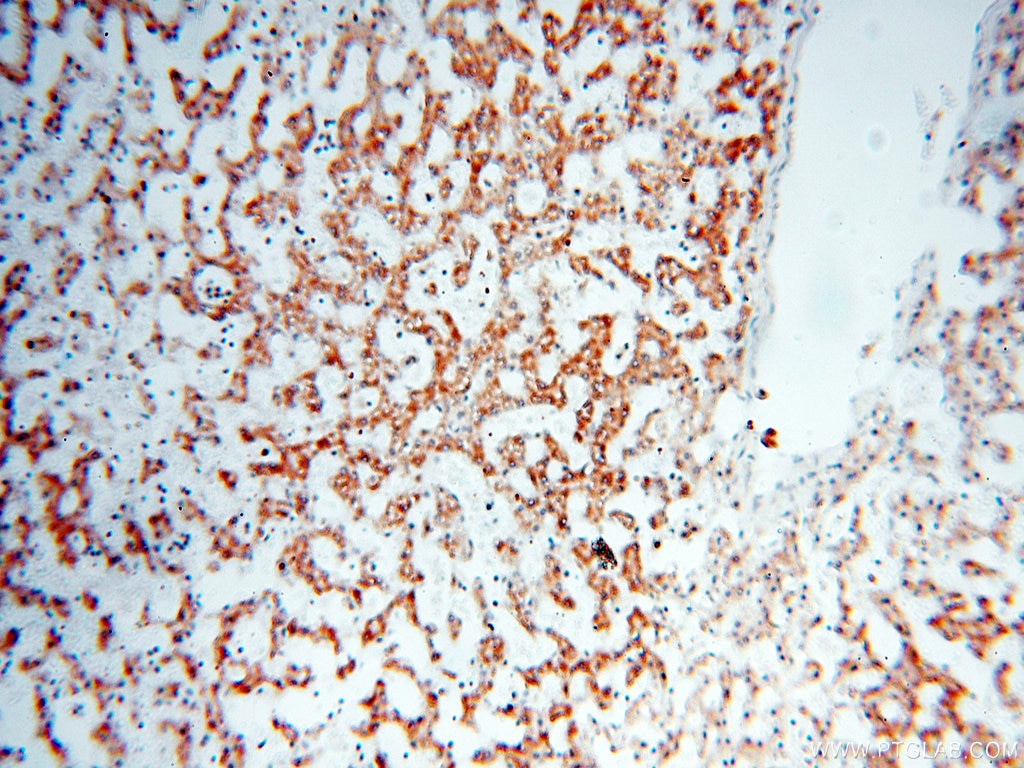 Immunohistochemistry (IHC) staining of human liver tissue using COQ5 Polyclonal antibody (17453-1-AP)