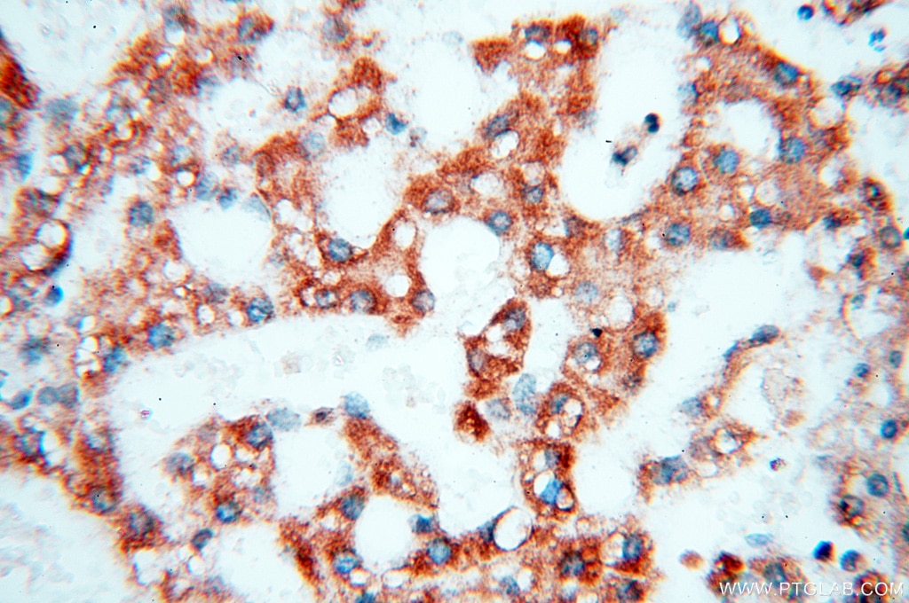 Immunohistochemistry (IHC) staining of human liver tissue using COQ5 Polyclonal antibody (17453-1-AP)