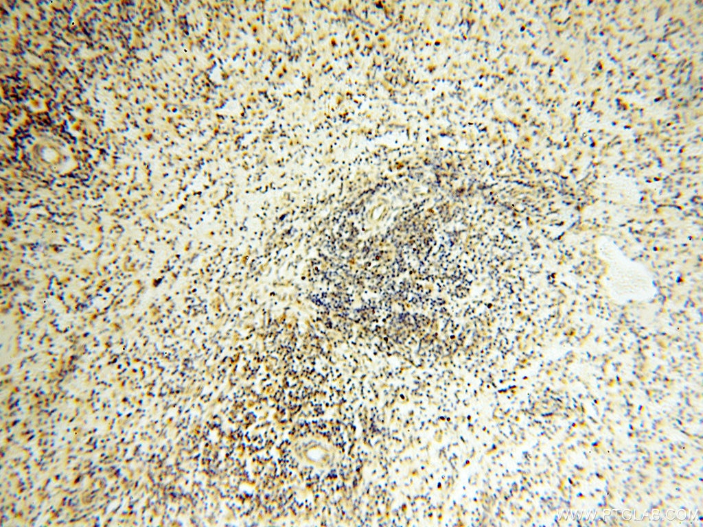 Immunohistochemistry (IHC) staining of human spleen tissue using COQ5 Polyclonal antibody (17453-1-AP)