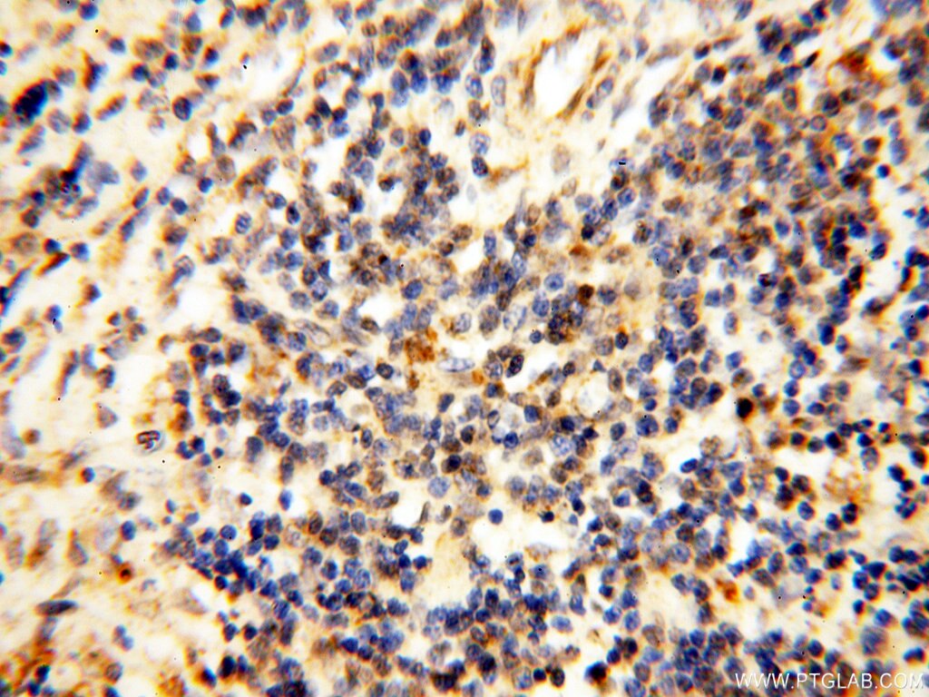 Immunohistochemistry (IHC) staining of human spleen tissue using COQ5 Polyclonal antibody (17453-1-AP)