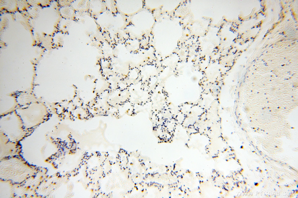Immunohistochemistry (IHC) staining of human lung tissue using COQ5 Polyclonal antibody (17453-1-AP)