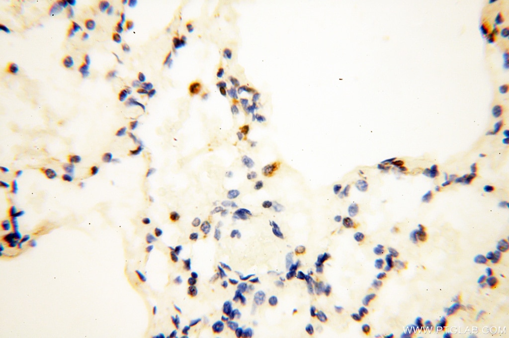 Immunohistochemistry (IHC) staining of human lung tissue using COQ5 Polyclonal antibody (17453-1-AP)