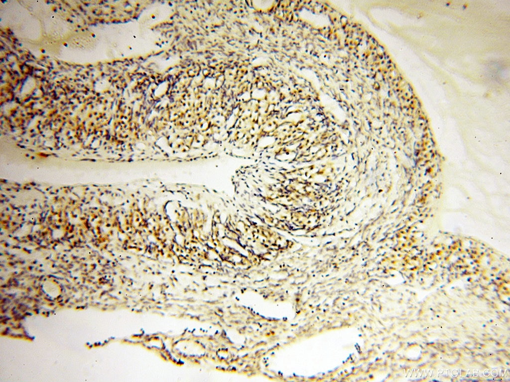 Immunohistochemistry (IHC) staining of human ovary tissue using COQ5 Polyclonal antibody (17453-1-AP)