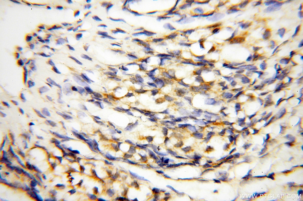 Immunohistochemistry (IHC) staining of human ovary tissue using COQ5 Polyclonal antibody (17453-1-AP)