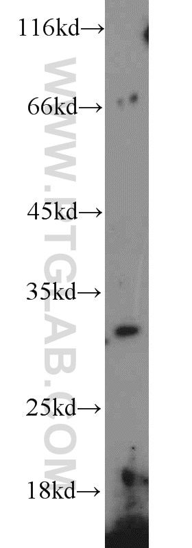 Western Blot (WB) analysis of mouse liver tissue using COQ5 Polyclonal antibody (17453-1-AP)