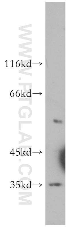 Western Blot (WB) analysis of mouse brain tissue using COQ5 Polyclonal antibody (17453-1-AP)