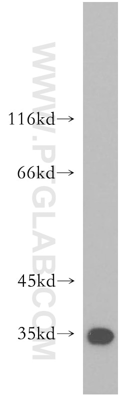 WB analysis of mouse heart using 17453-1-AP