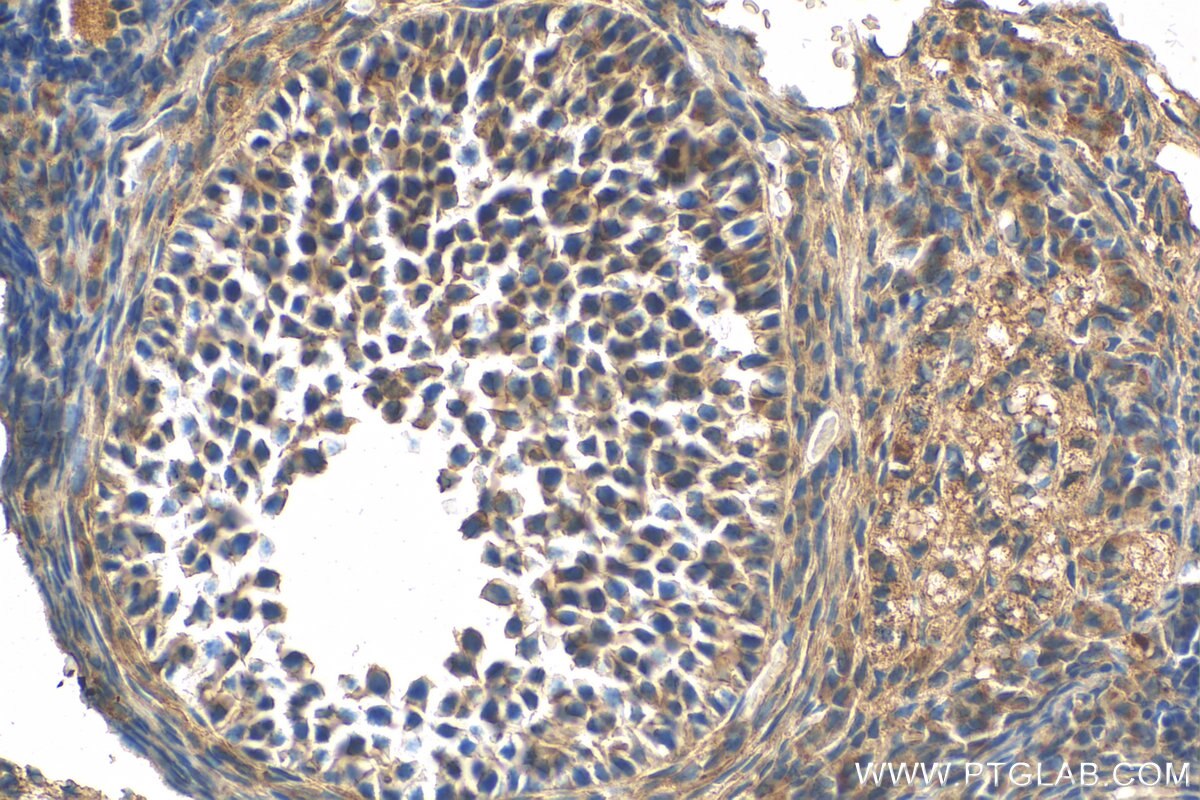 Immunohistochemistry (IHC) staining of mouse ovary tissue using COQ6 Polyclonal antibody (12481-1-AP)