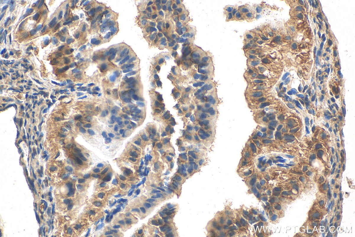 Immunohistochemistry (IHC) staining of mouse ovary tissue using COQ6 Polyclonal antibody (12481-1-AP)