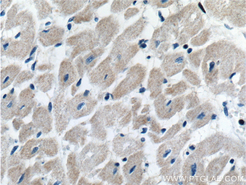 Immunohistochemistry (IHC) staining of human heart tissue using COQ6 Polyclonal antibody (12481-1-AP)