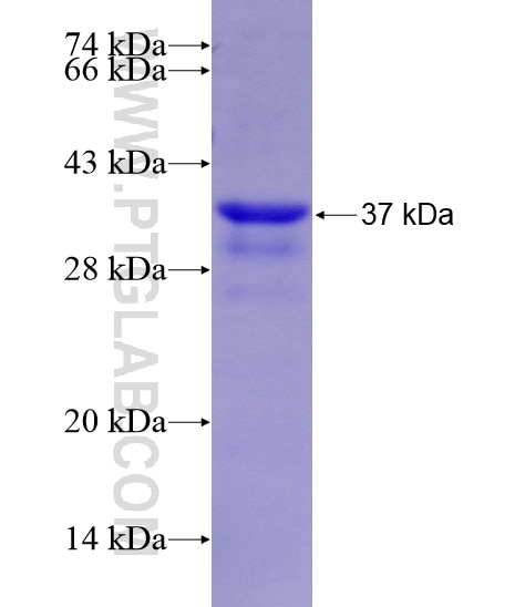 COQ6 fusion protein Ag28991 SDS-PAGE