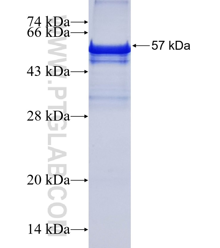 COQ6 fusion protein Ag3164 SDS-PAGE