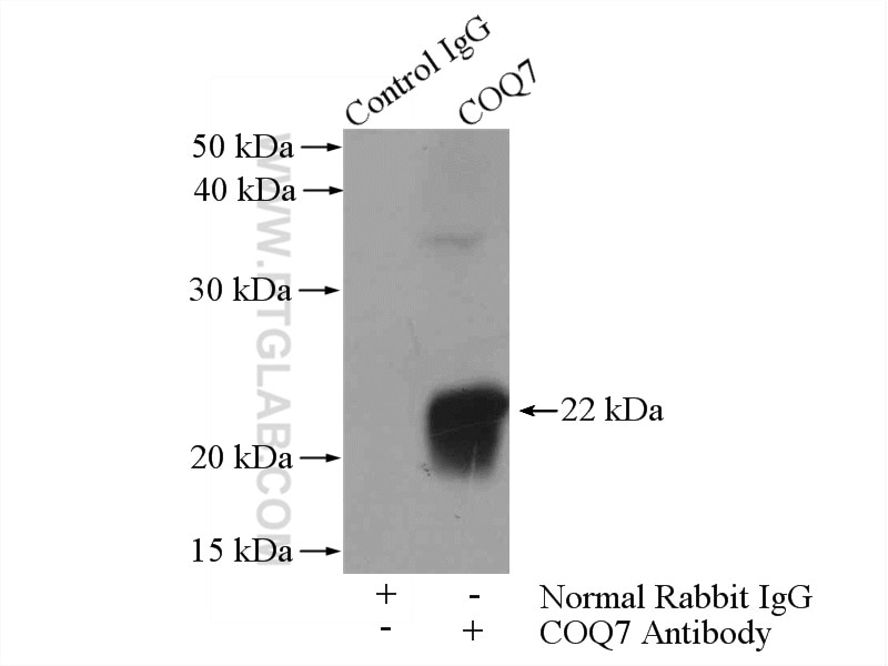 Immunoprecipitation (IP) experiment of mouse liver tissue using COQ7 Polyclonal antibody (15083-1-AP)