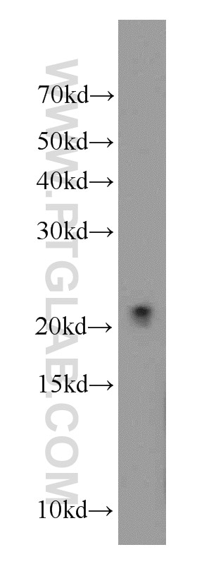 Western Blot (WB) analysis of mouse liver tissue using COQ7 Polyclonal antibody (15083-1-AP)