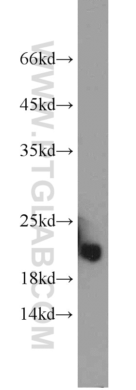 Western Blot (WB) analysis of mouse heart tissue using COQ7 Polyclonal antibody (15083-1-AP)