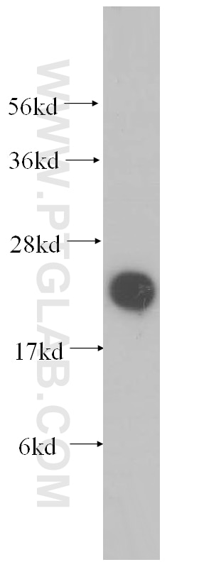 Western Blot (WB) analysis of mouse liver tissue using COQ7 Polyclonal antibody (15083-1-AP)