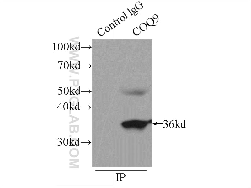 Immunoprecipitation (IP) experiment of HeLa cells using COQ9 Polyclonal antibody (14874-1-AP)
