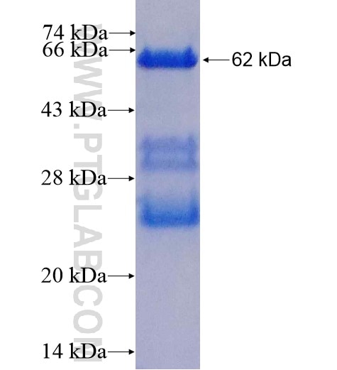 COQ9 fusion protein Ag6645 SDS-PAGE